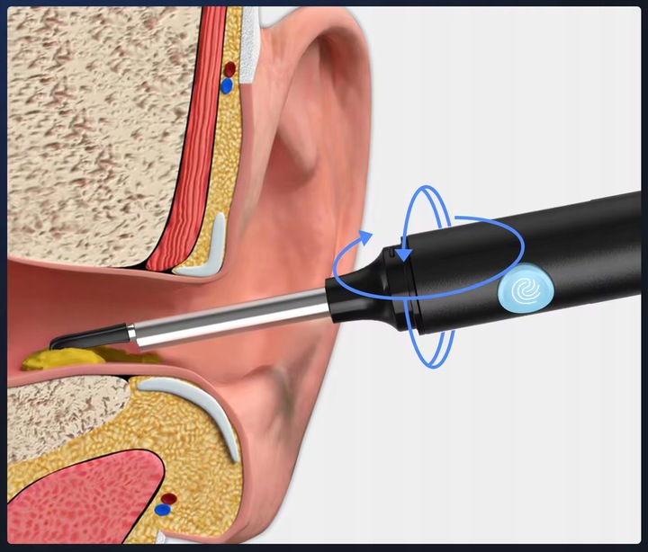 OTOSKOP SMART KAMERA CZYSZCZENIE USZU WOSK WIFI APLIKACJA ENDOSKOP HEELLY