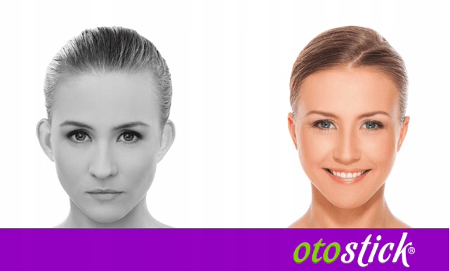 OTOSTICK Korektory Estetyczne Uszu 8szt + Waciki Oczyszczające Skórę