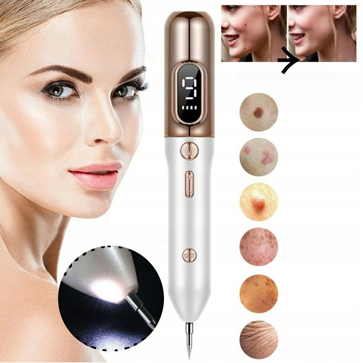 PIÓRO DO LASER USUWANIA ZNAMION PLAZMOWE DO USUWANIA BRODAWEK PIEPRZYK