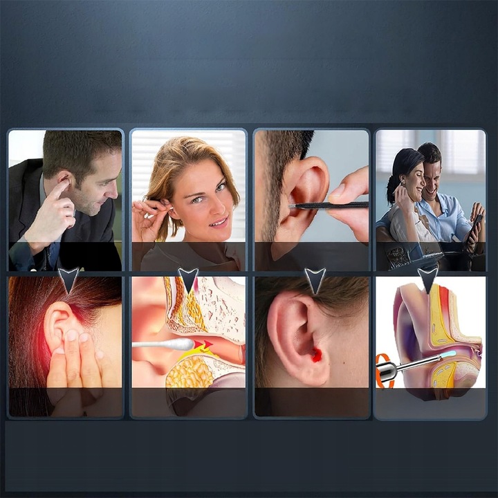 SMART OTOSKOP Z KAMERKĄ WIFI DO CZYSZCZENIA USZU NARZĘDZIA ZESTAW ENDOSKOP