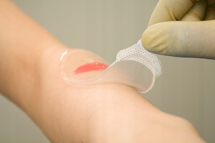 OPATRUNEK HYDROŻELOWY na oparzenia RATUNKOWY Kikgel BurnTec 12cmx12 cm 1szt