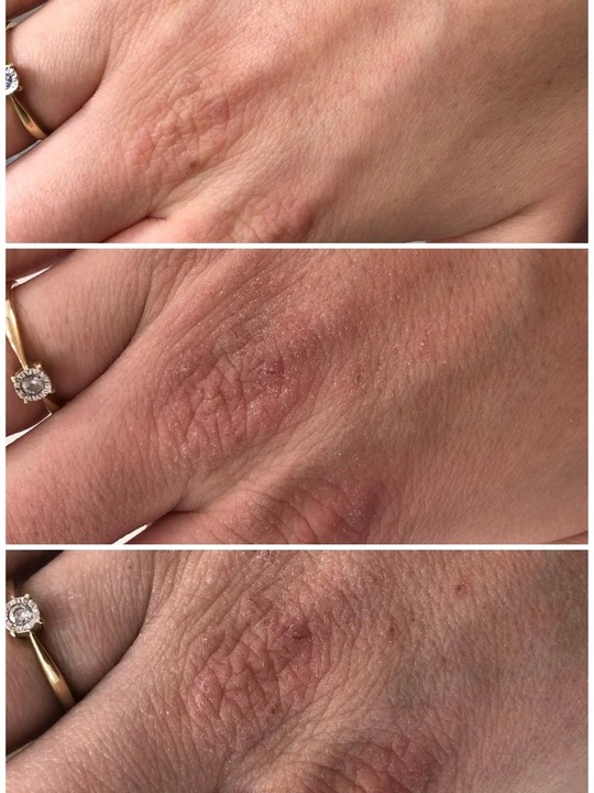 Krem do rąk Hud Salva z witaminą E 100 ml Swederm Hudsalva Vit E