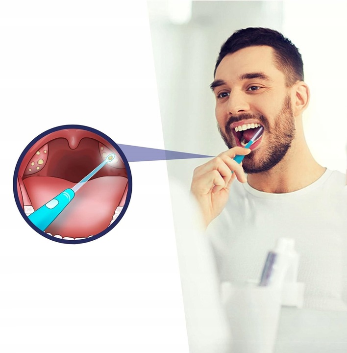 Zestaw LED do usuwania kamieni migdałkowych GRATIS