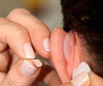 Otostick Korektory Estetyczne Uszu 8 sztuk GRATIS