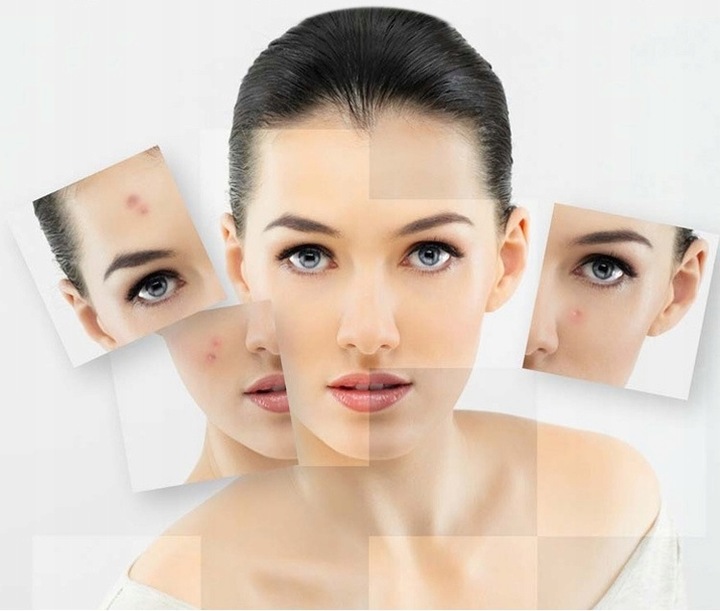 ZESTAW DO USUWANIA BRODAWEK ZMIAN SKÓRNYCH TATUAŻY BLIZN PLAZMA PEN LASER