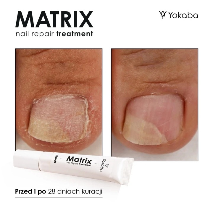 Yokaba MATRIX Preparat do regeneracji macierzy paznokcia 15 ml