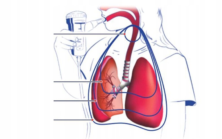 ZESTAW AKCESORIÓW Z NEBULIZATOREM RF7 DUAL SPEED PLUS DO NEBULAIR FLAEM