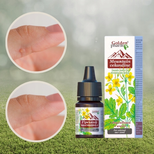 GLISTNIK GÓRSKI JASKÓŁCZE ZIELE WŁÓKNIAKI KURZAJKI BRODAWKI MODZELE 20 ml