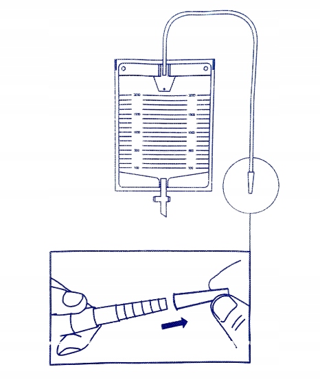 Worek Medyczny Do Zbiórki Moczu Sterylny Z Zaworem T 2L 90cm 30 Sztuk Zarys