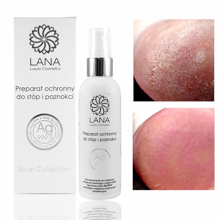 SPRAY Z JONAMI SREBRA na GRZYBICĘ PAZNOKCI 3x100ml