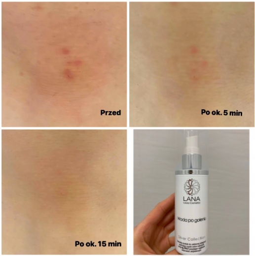 Ag+ Preparat po depilacji MIEJSC INTYMNYCH 100ml