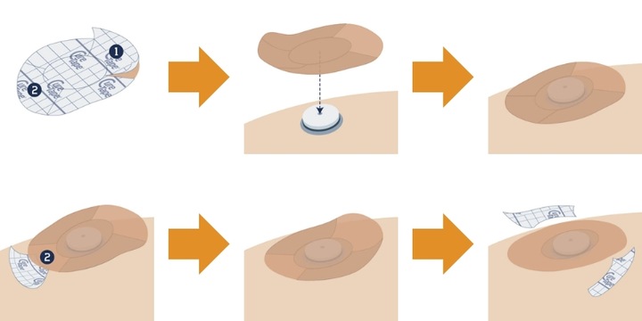 PLASTRY OCHRONNE NA SENSOR CURETAPE CGM do FREESTYLE LIBRE - MIX - 8