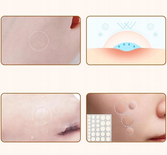 Plaster na Pryszcze trądzik do pryszczy Pimple Patches na Wypryski