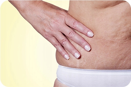 Bio Oil Naturalny, olejek do pielęgnacji skóry, 200 ml