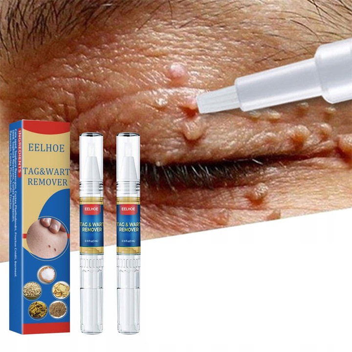 Oryginalne Pióro Do Usuwania Brodawek