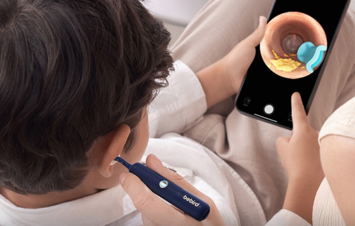 Smart Otoskop Z Kamerą Do Czyszczenia Uszu Bebird Earsight Plus Zestaw