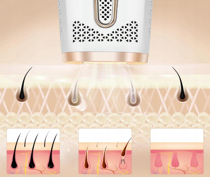 DEPILATOR LASEROWY IPL DO WŁOSÓW TWARZY CIAŁA BIKINI DEPILACJA