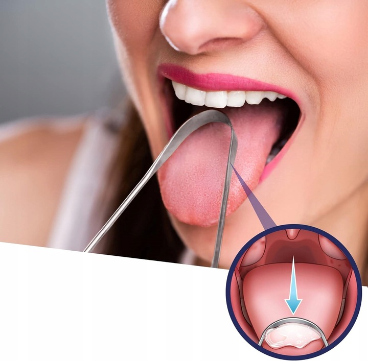 Zestaw LED do usuwania kamieni migdałkowych GRATIS