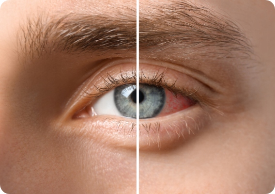 Hialeye Duo + Hialeye krople do oczu 0,2%