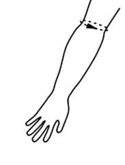 STABILIZATOR NA ŁOKIEĆ TENISISTY GOLFISTY OPASKA ELASTYCZNA ŁOKCIA