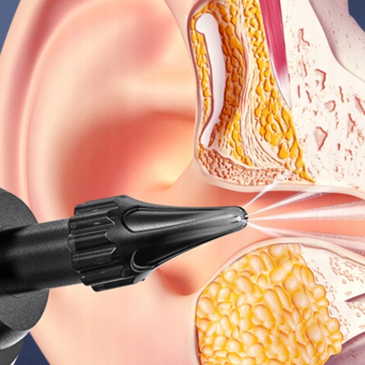 IRYGATOR URZĄDZENIE CZYSZCZENIA USZU PŁUKANIA WOSKOWINY BEZPRZEWODOWY