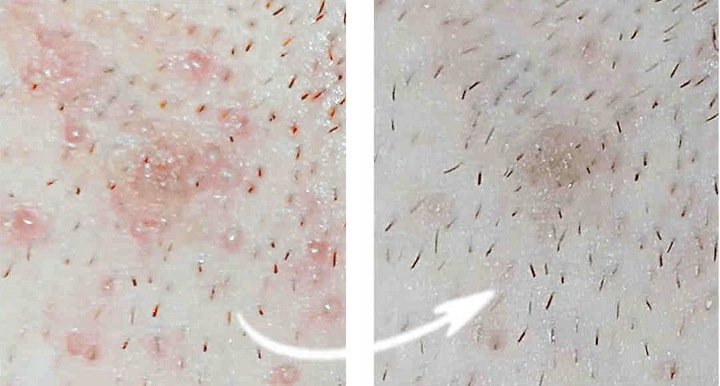 Ag+ Preparat po depilacji MIEJSC INTYMNYCH 100ml