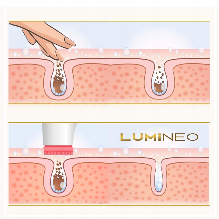 Lumineo Brush PRO różowy 4 końcówki + żel do skóry problematycznej