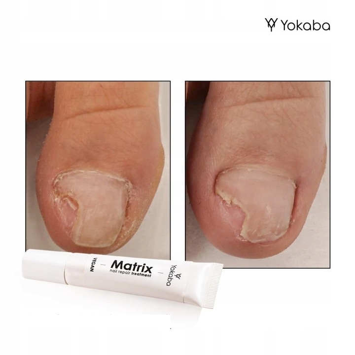 Yokaba Matrix Nail Repair Treatment Preparat do regeneracji paznokci 15ml