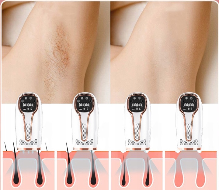 DEPILATOR LASEROWY IPL DO WŁOSÓW CIAŁA BIKINI NÓG DEPILACJA BEZBOLESNY