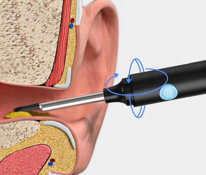 Smart Otoskop Kamera Czyszczenie Uszu Do Usuwania Woskowiny Wosk Wifi