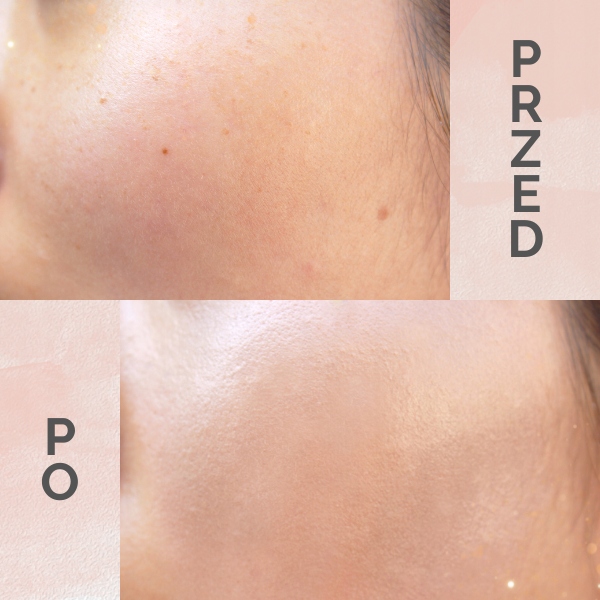 Podkład w kompakcie Dr.HEDISON Miracle Cushion SPF 50+ Natural Beige 2x15g