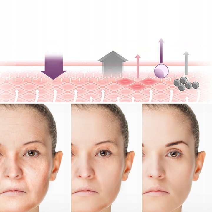 FOONNUN BEZIGŁOWA MASAŻER EMS TWARZY LIFTING 7w1 URZĄDZENIE DO MASAŻU