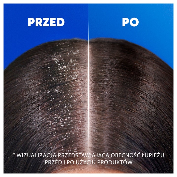 HEAD&SHOULDERS Szampon CITRUS FRESH 800ml