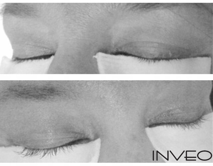 Odżywka do rzęs, serum do rzęs przyśpieszające wzrost long lashes z INVEO