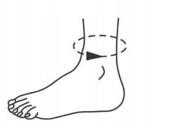 ORTEZA STAWU SKOKOWEGO STABILIZATOR STOPY I KOSTKI OPASKA NA STOPĘ I KOSTKĘ