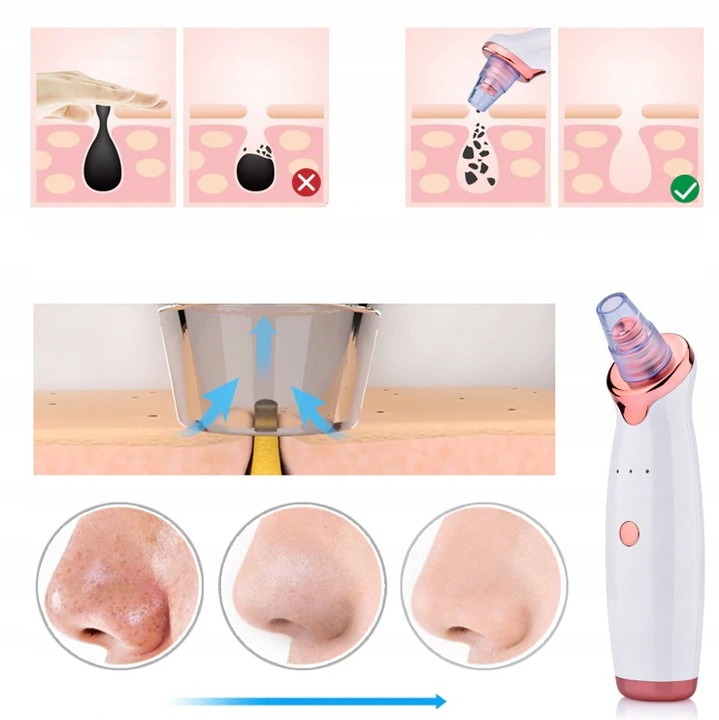 ODKURZACZ WĄGRÓW 12w1 Mikrodermabrazja + Masażer +