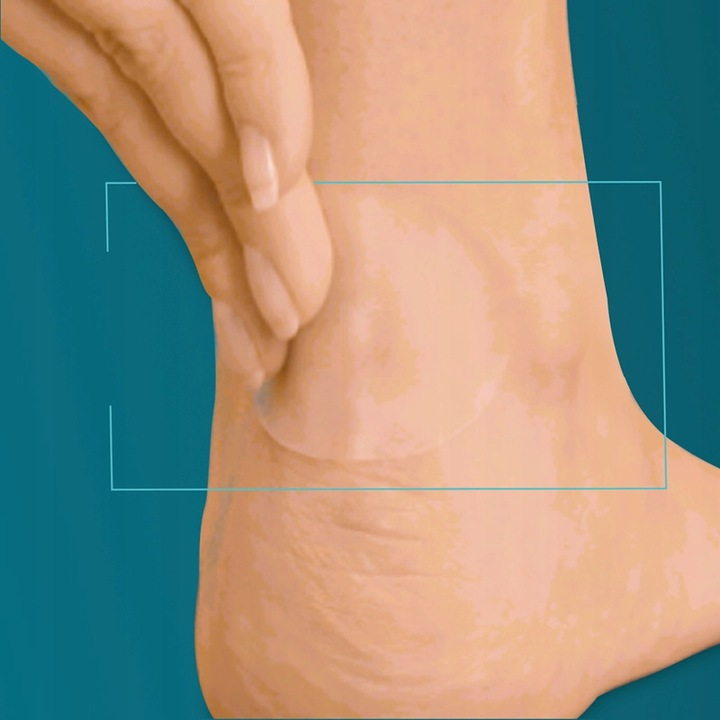 COMPEED plastry na pęcherze odciski mix 5 szt