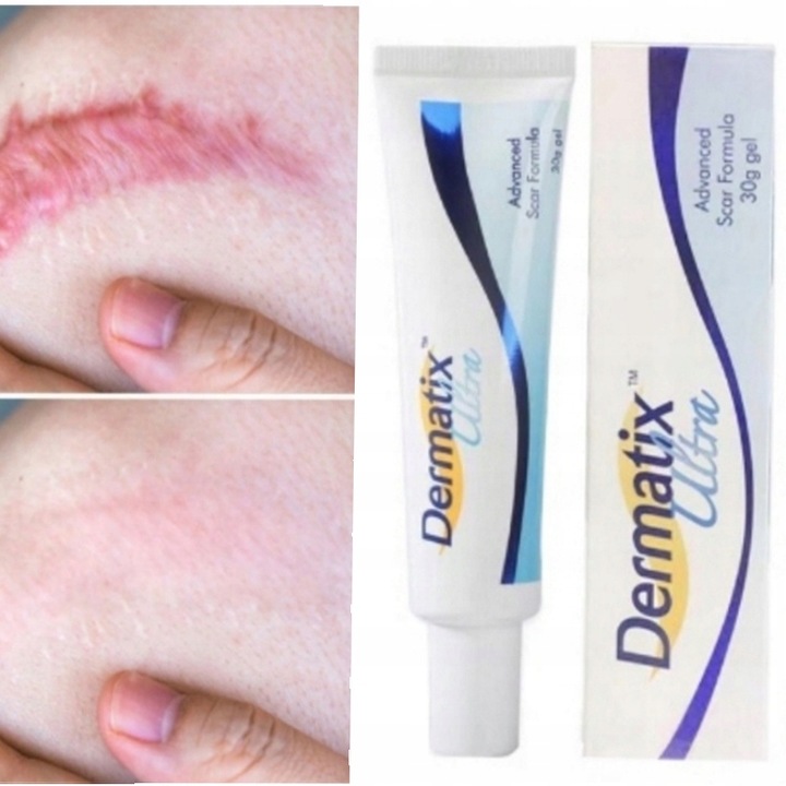 Dermatix żel na blizny 15 g