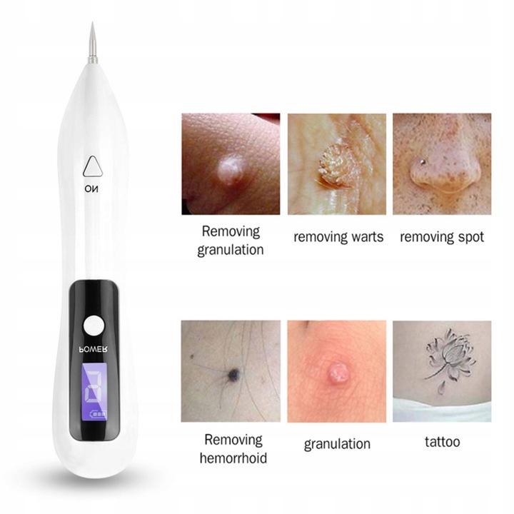 DŁUGOPIS PLAZMOWY DO USUWANIA ZNAMION I BRODAWEK BIAŁY