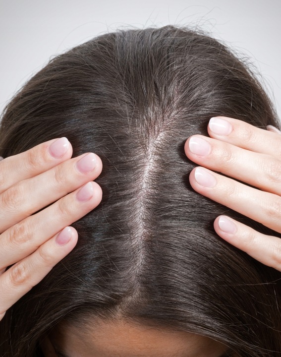 Kuracja przeciw wypadaniu włosów Seboradin FORTE 14 x 5,5 ml