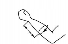 STABILIZATOR NADGARSTKA DŁONI OBEJMUJĄCY KCIUK ORTEZA STAWU NADGARSTKOWEGO