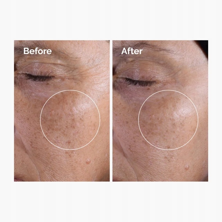 Ordinary Glycolic Acid 7% Toning Solution Tonik Peeling Glikolowy