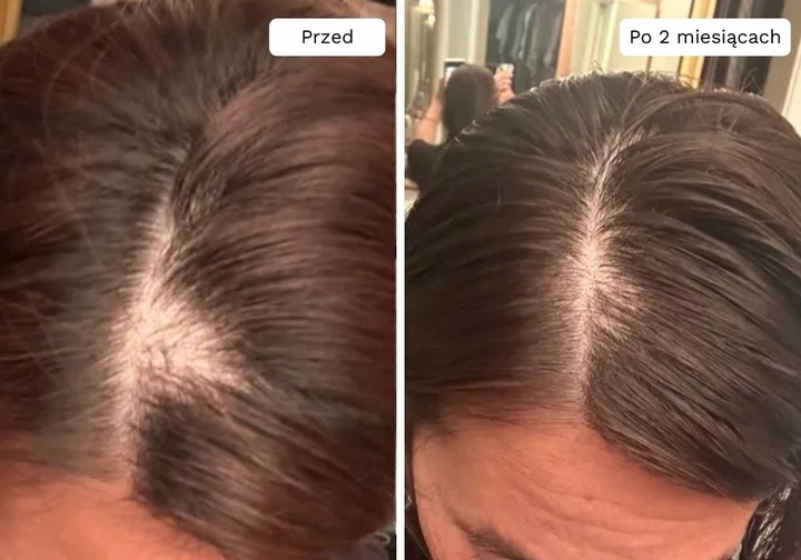 Wcierka Serum na porost i wypadanie włosów wzmacnia cebulki - Lavress 10w1