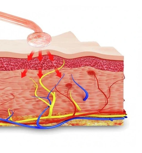 DARSONVAL DERMA WAND DARSONWAL MOCNY 4 PELOTY