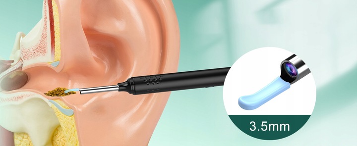 SMART OTOSKOP Z KAMERKĄ WIFI DO CZYSZCZENIA USZU NARZĘDZIA ZESTAW ENDOSKOP