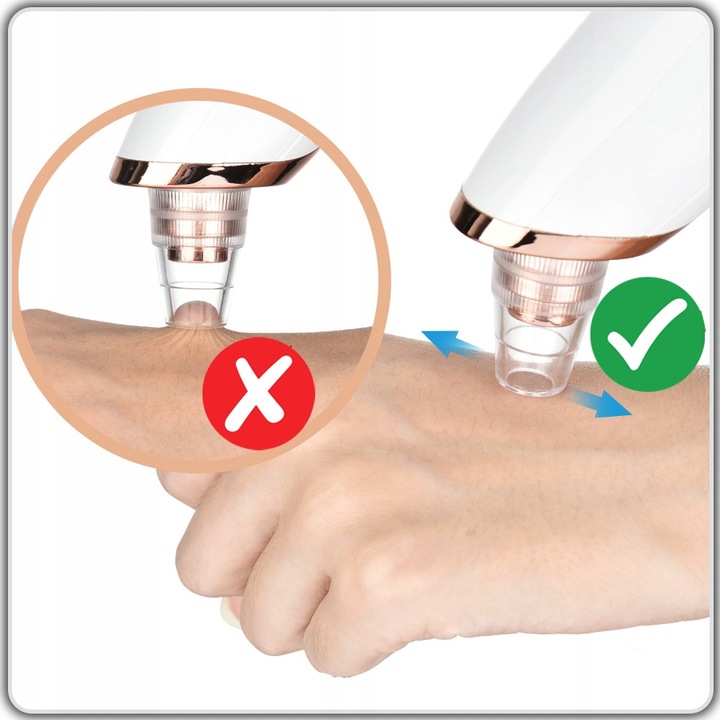 ELEKTRYCZNY PRZYRZĄD ODKURZACZ DO WĄGRÓW PRYSZCZY ZASKÓRNIKÓW 15w1