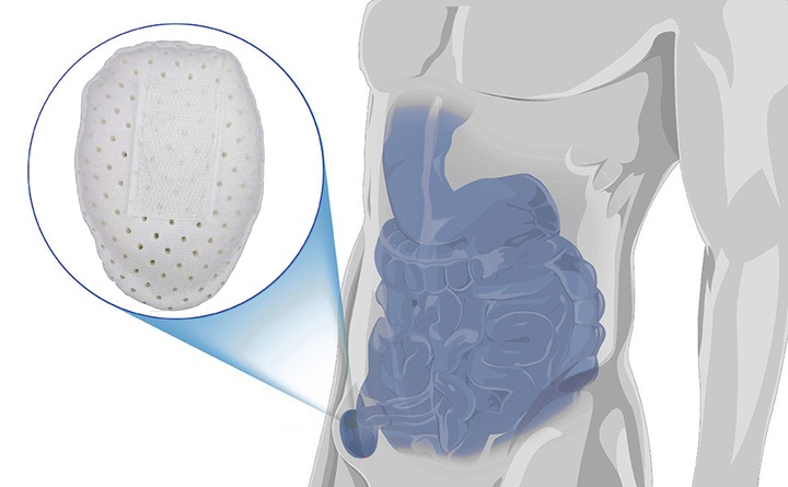 MEDYCZNY PAS PRZEPUKLINOWY PACHWINOWY DO LEWA I PRAWA STRONY 75-92 cm BIAŁY