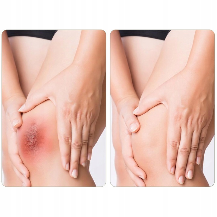 Plastry hydrokoloidowe ochronne szybkie gojenie odcisków pęcherzy