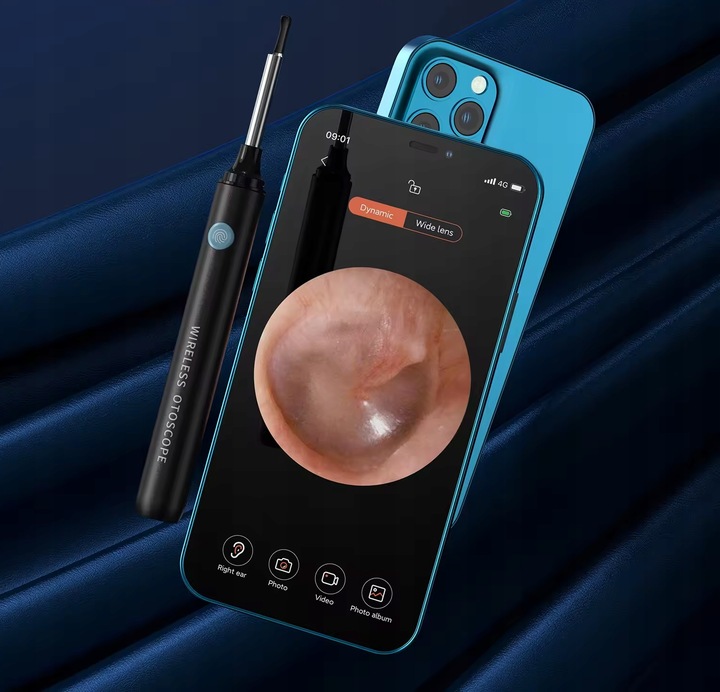 OTOSKOP SMART KAMERA CZYSZCZENIE USZU WOSK WIFI APLIKACJA ENDOSKOP HEELLY