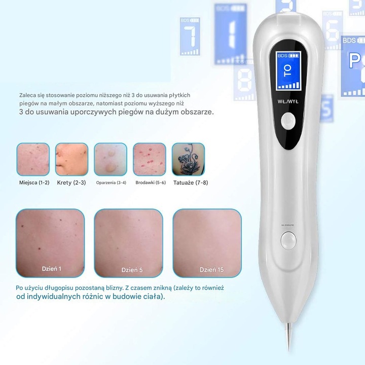 PLAZMA PEN USUWANIE BRODAWEK WŁÓKNIAKÓW AKUMULATOR 9 POZIOMÓW MOCY